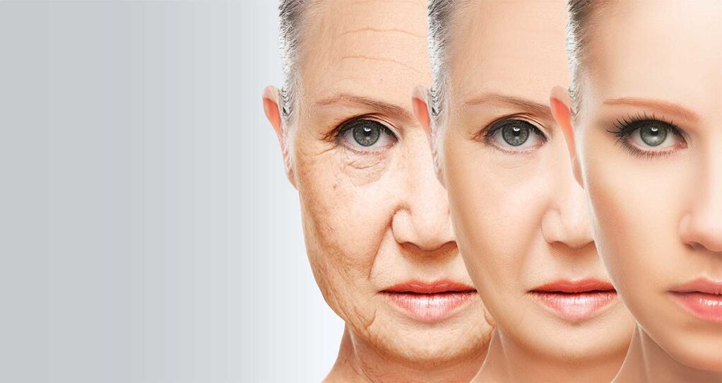Pomlajevanje kože obraza z lasersko tehnologijo