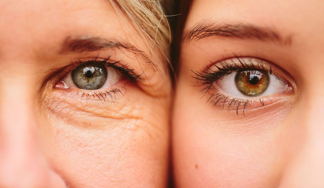 znaki staranja okoli oči